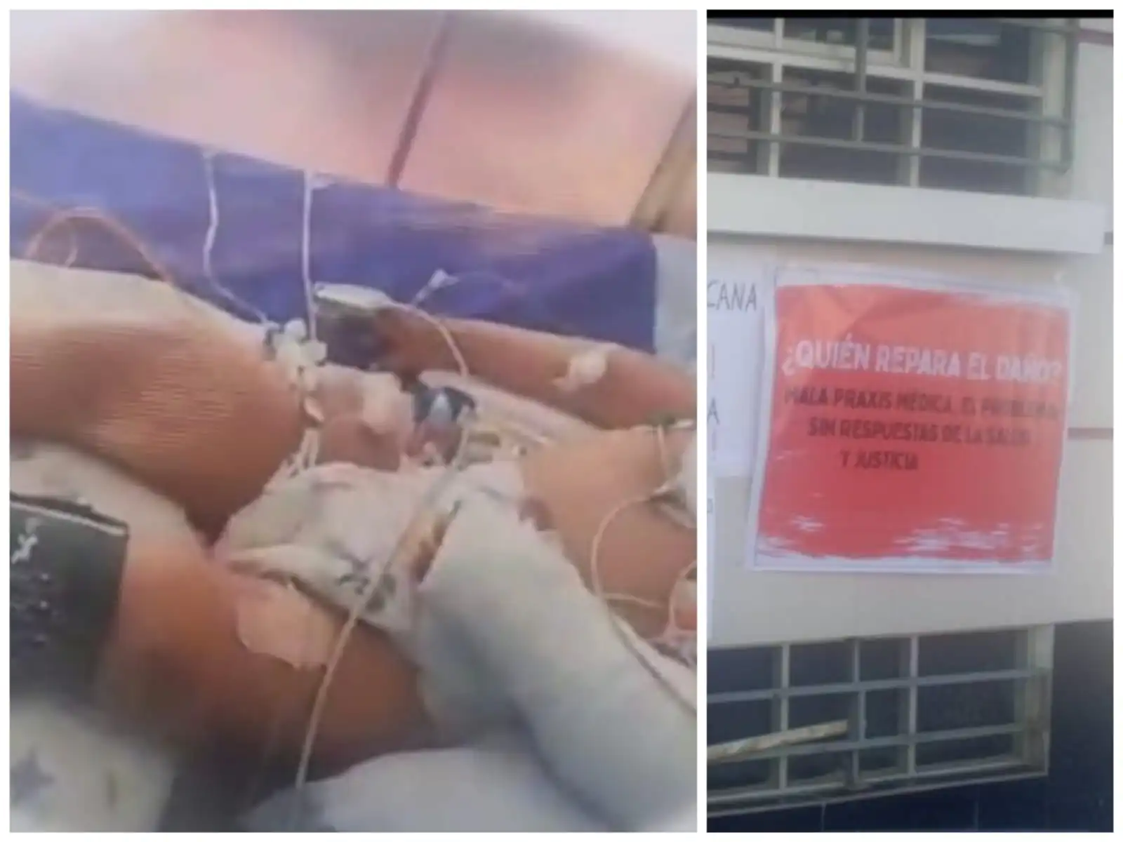 Matías, de un año y nueve meses quedó con muerte cerebral por una presunta sobredosis de anestesia. FOTO: RRSS